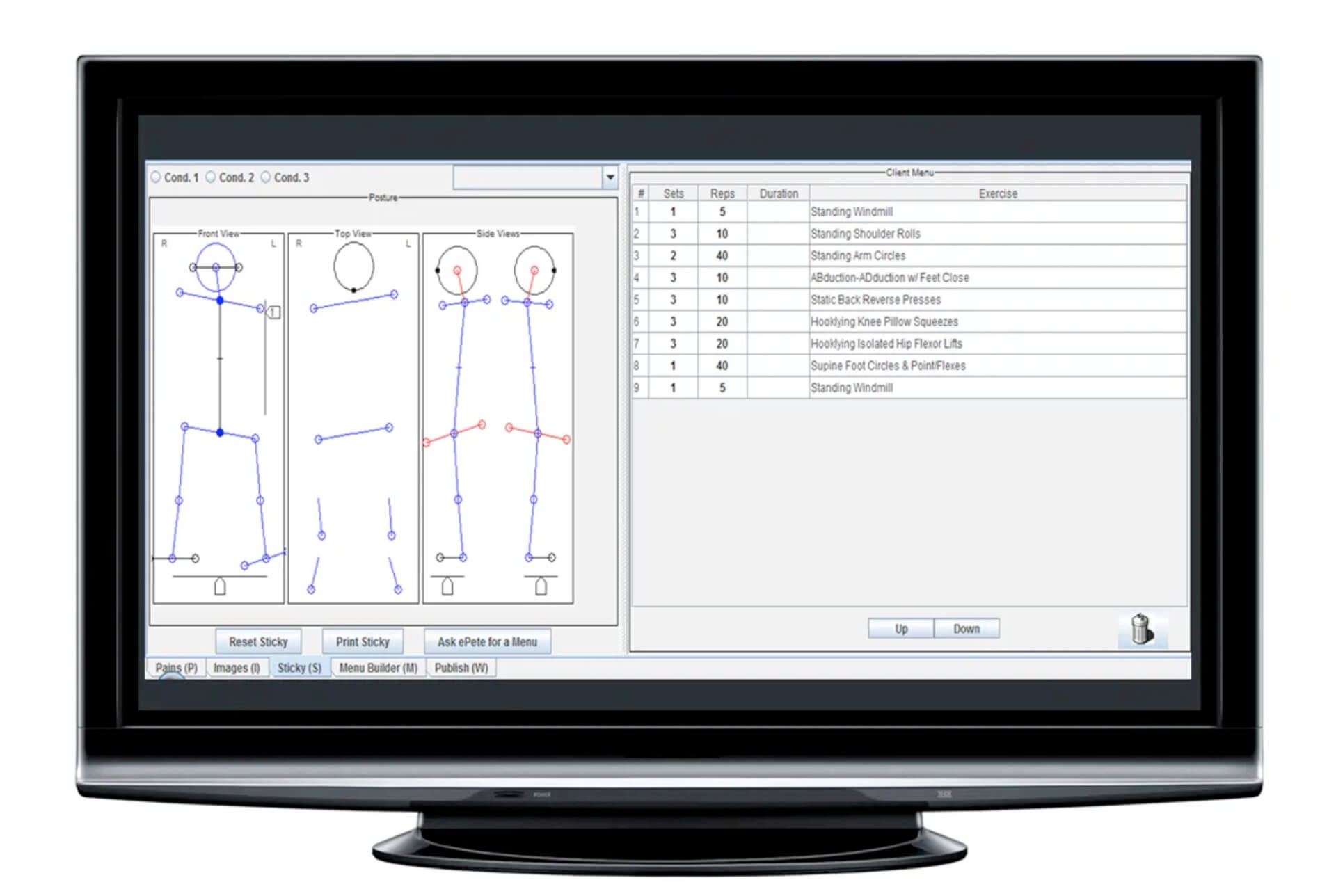 tab on a computer monitor showing graphics with lines and points and a list of excercises